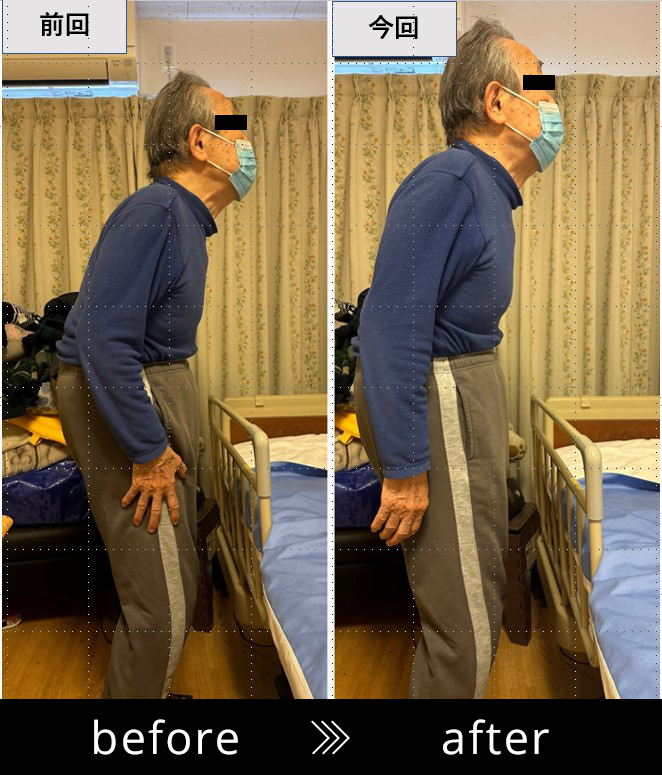 ビフォーアフター01