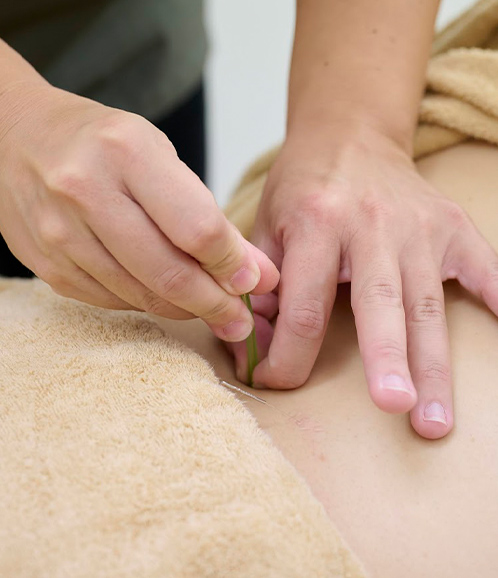 はり施術