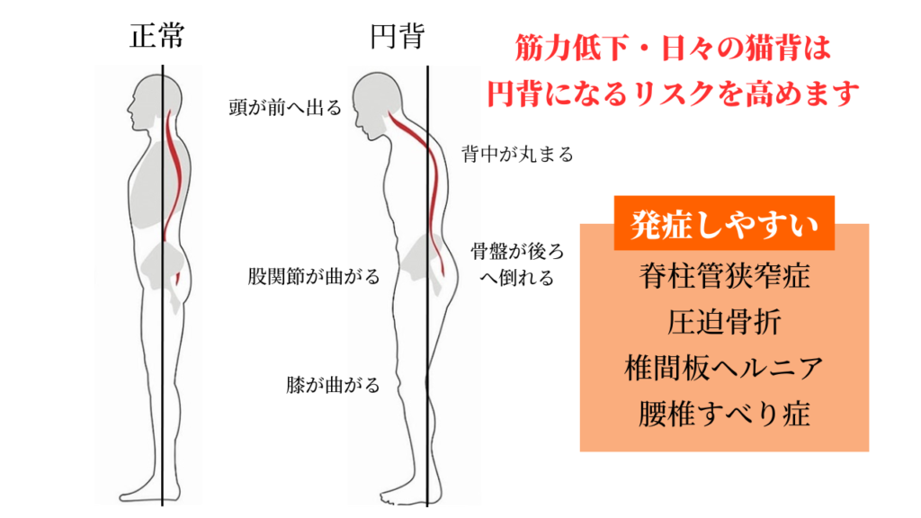円背 - 海老名市|Noa接骨院はりきゅう院マッサージ院